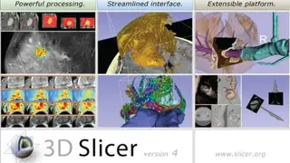 3D Slicer screenshot