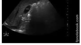 Abdomino-Pelvic Ultrasound Guide screenshot