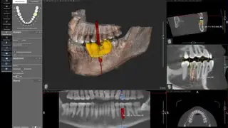 ACTEON Imaging Suite (AIS) screenshot