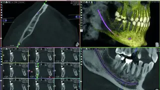 ACTEON Imaging Suite (AIS) screenshot