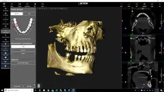 ACTEON Imaging Suite (AIS) screenshot