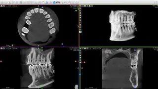 ACTEON Imaging Suite (AIS) screenshot