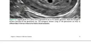Advances in Ultrasound in Obstetrics & Gynecology screenshot