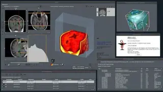 Aliza screenshot