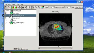 AMIDE screenshot