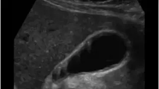 ARDMS Ultrasound Flashcards Lt screenshot