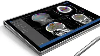 Athena DICOM Viewer screenshot
