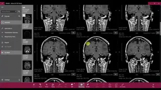 Athena DICOM Viewer screenshot