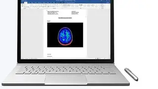 Athena DICOM Viewer screenshot