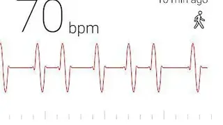Cardiograph screenshot