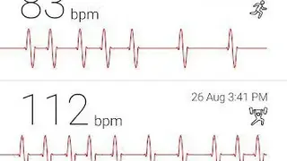 Cardiograph screenshot