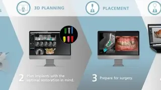 Carestream Dental screenshot