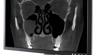Carestream Dental screenshot