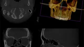 Carestream Dental screenshot