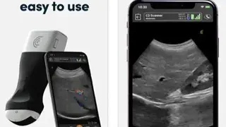 Clarius Ultrasound App screenshot