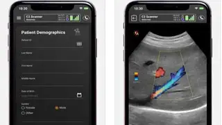 Clarius Ultrasound App screenshot