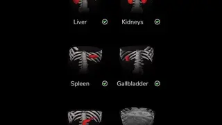 Deepscope Ultrasound Simulator screenshot