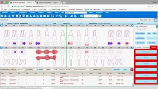 Denticon screenshot