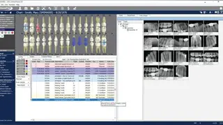 DentiMax screenshot