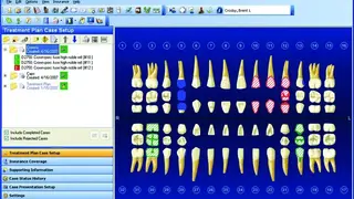Dentrix screenshot