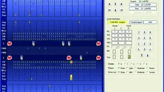 Dentrix screenshot