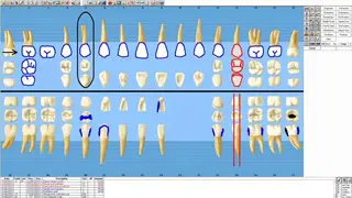 Dentrix Enterprise screenshot