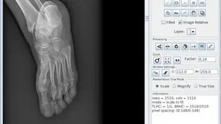 DICOMscope screenshot