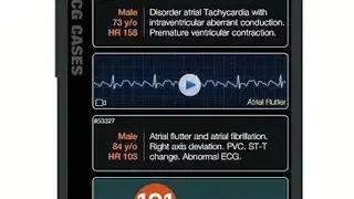 ECG Pro screenshot