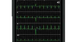 ECG Pro screenshot