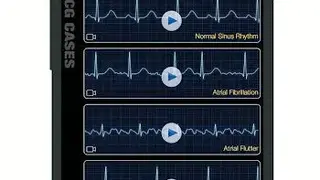 ECG Pro screenshot