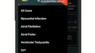 ECG Pro screenshot