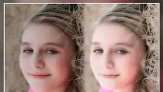 Face Warp – Plastic Surgery screenshot