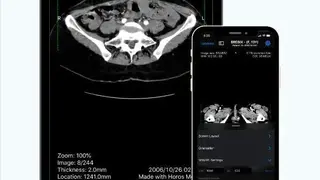 Horos screenshot