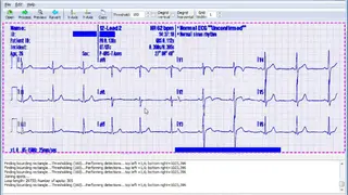 Im2graph screenshot