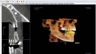 Invivo 5 screenshot