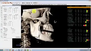 Invivo 5 screenshot