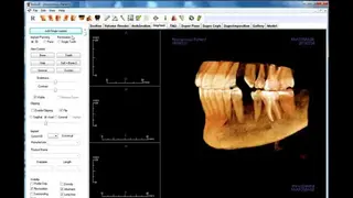 Invivo 5 screenshot