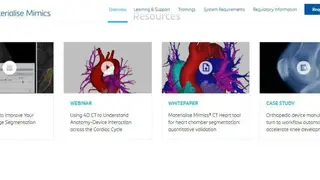 Materialise Mimics screenshot