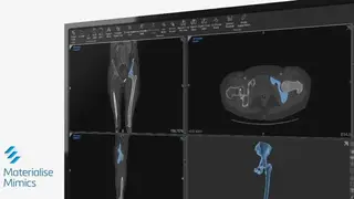 Materialise Mimics screenshot
