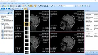 MicroDicom screenshot