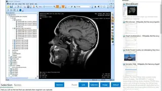 MicroDicom screenshot