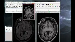 MIPAV screenshot