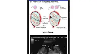 Obstetrics & Gyenacology Ultrasound Guide screenshot
