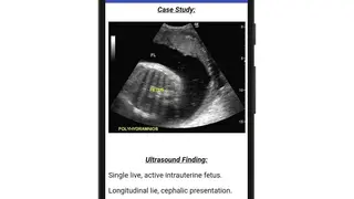 Obstetrics & Gyenacology Ultrasound Guide screenshot