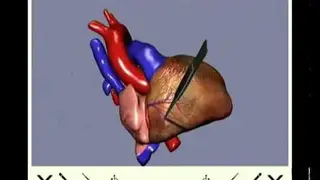 Open Heart Surgery Simulator screenshot