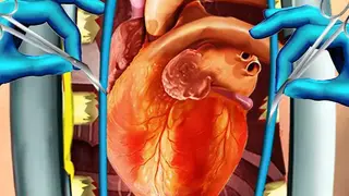 Open Heart Surgery Simulator screenshot
