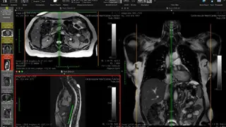 OsiriX screenshot