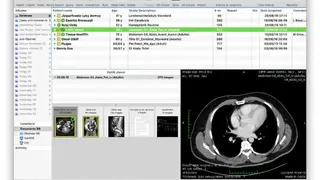 OsiriX screenshot