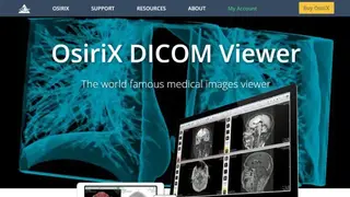 OsiriX screenshot