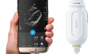 Philips Lumify Ultrasound App screenshot